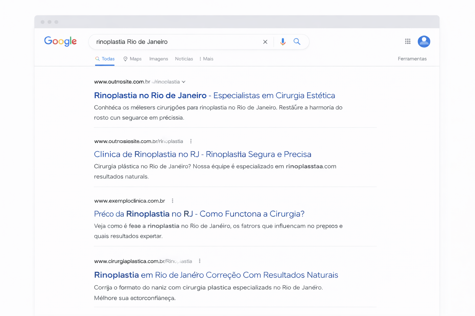 resultados orgânicos do Google para rinoplastia no Rio de Janeiro mostrando sites de clínicas e especialistas