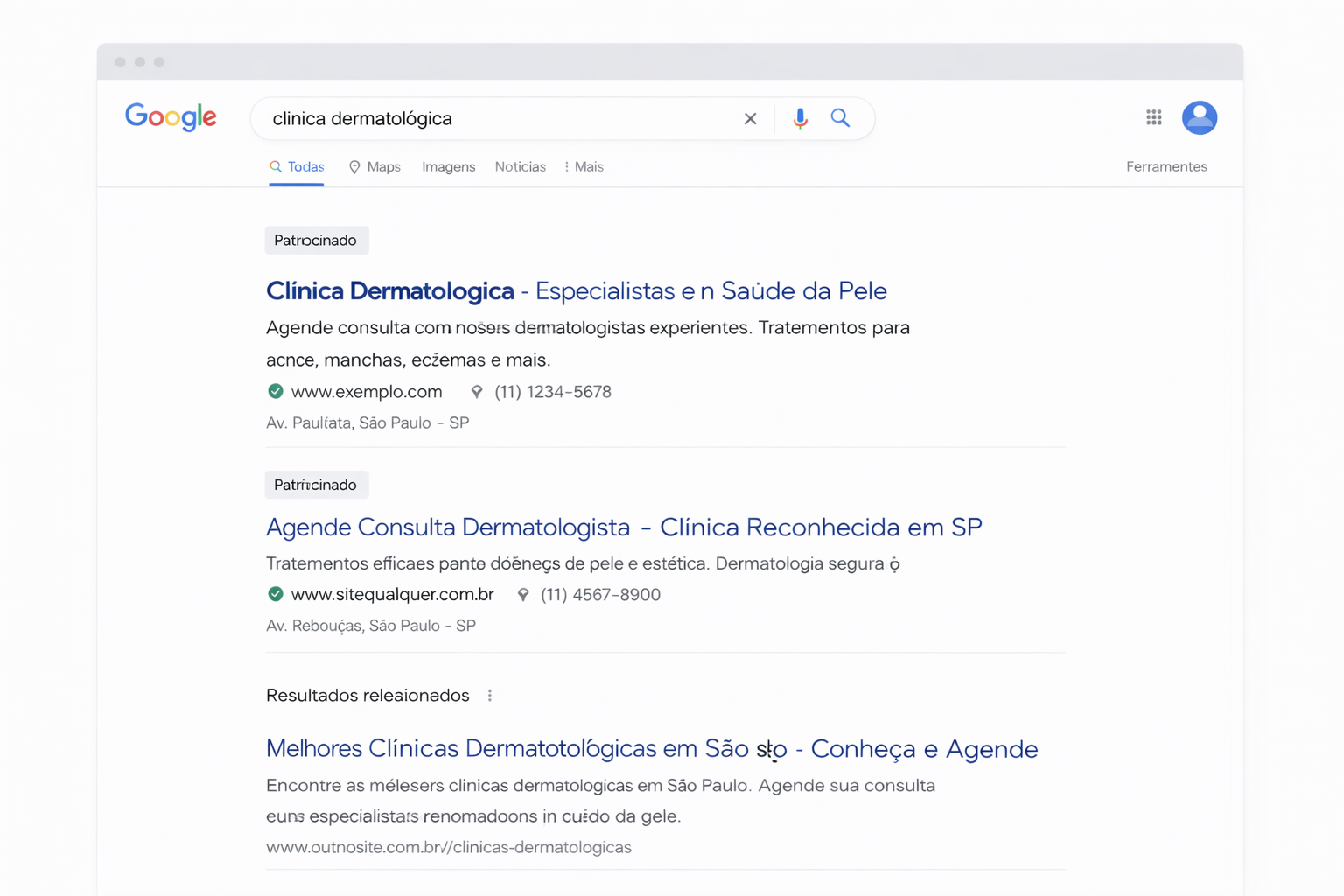 anúncios patrocinados no Google para clínica dermatológica com etiqueta patrocinado no topo da página